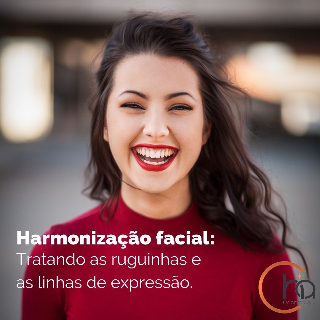 Harmonização facial 01