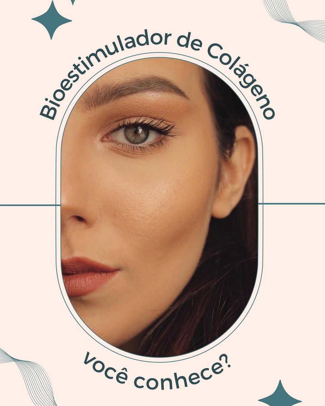 Harmonização facial 1