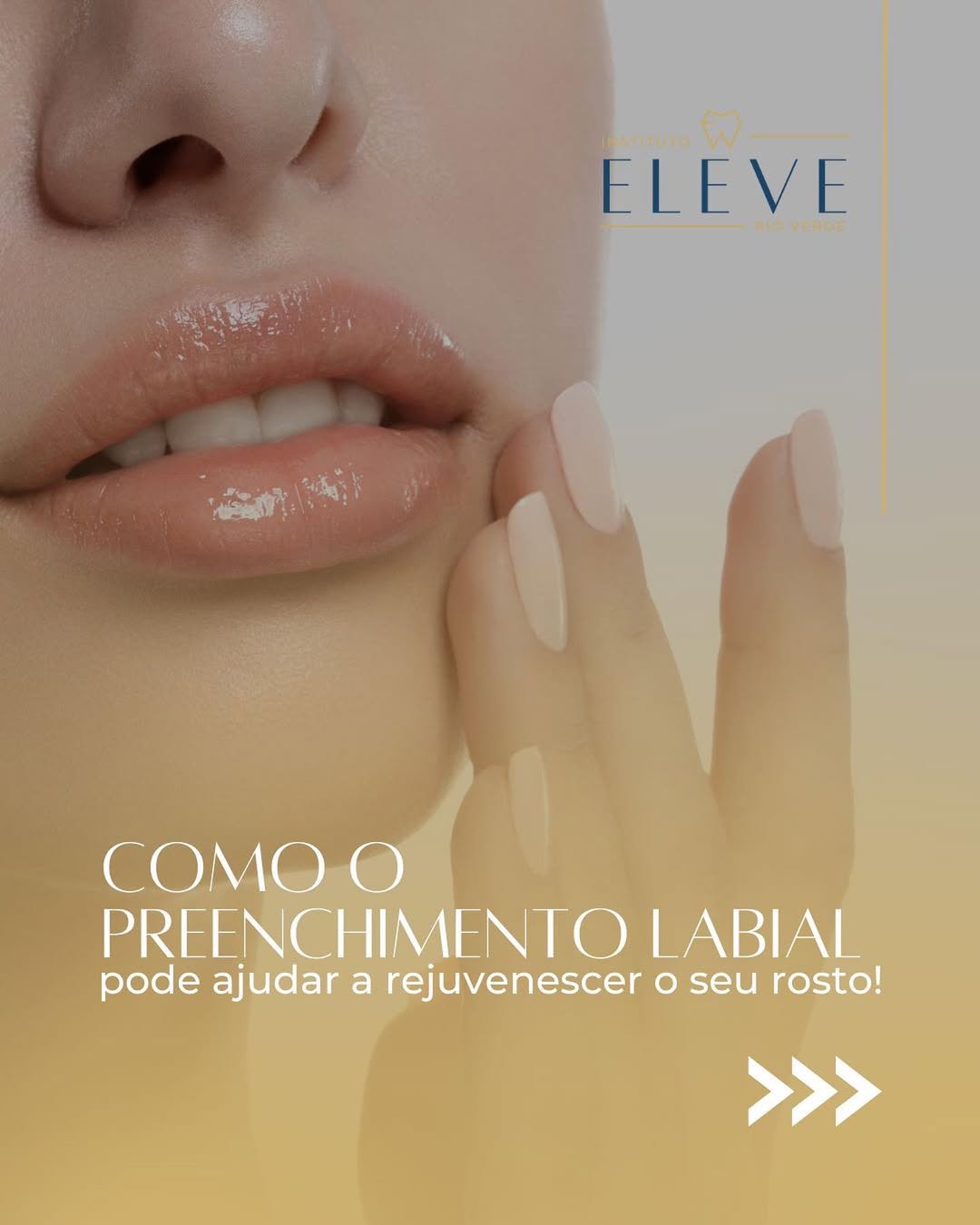 Harmonização facial 4