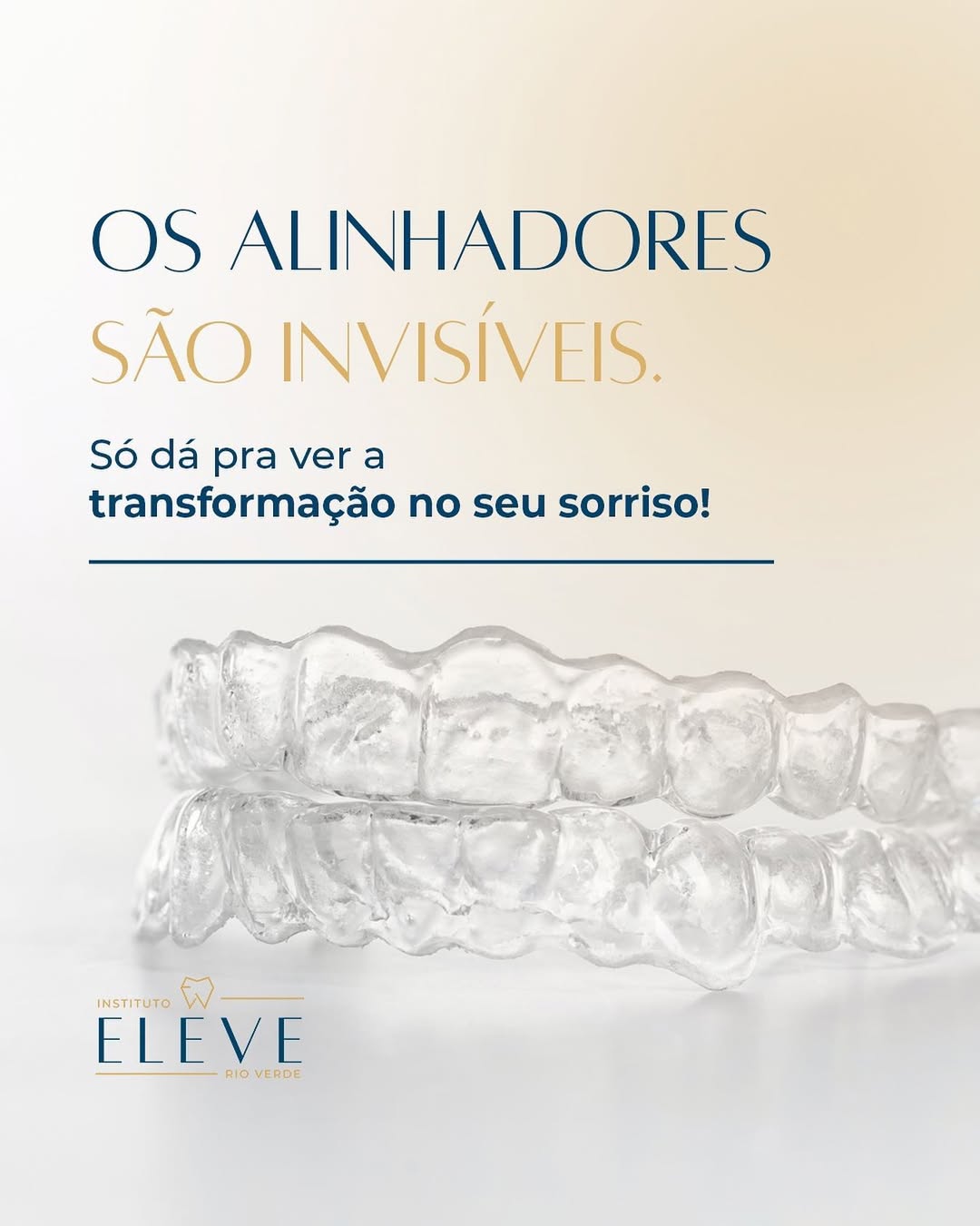 invisaling - aparelho ortodontico - aparelho dental 1