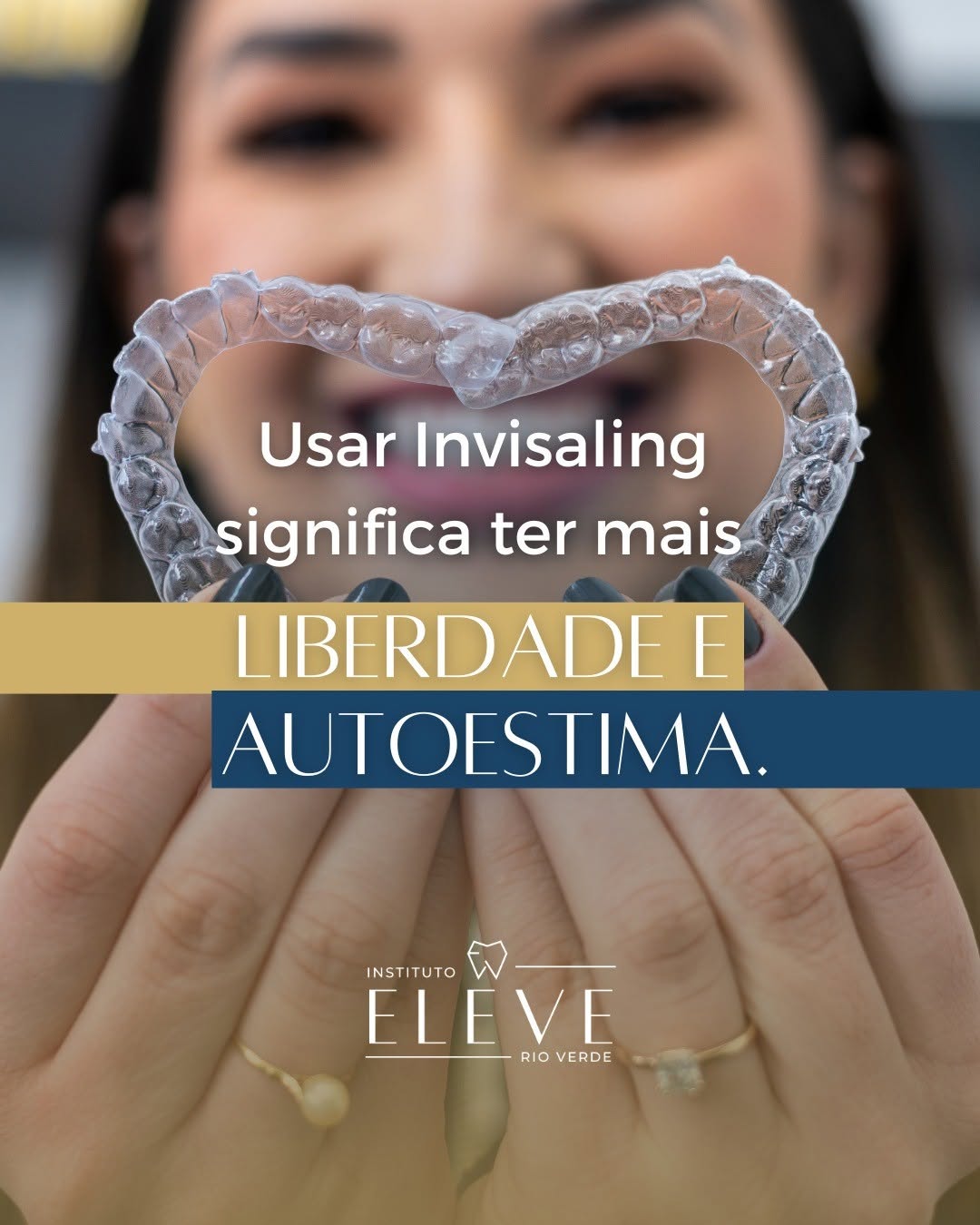 invisaling - aparelho ortodontico - aparelho dental