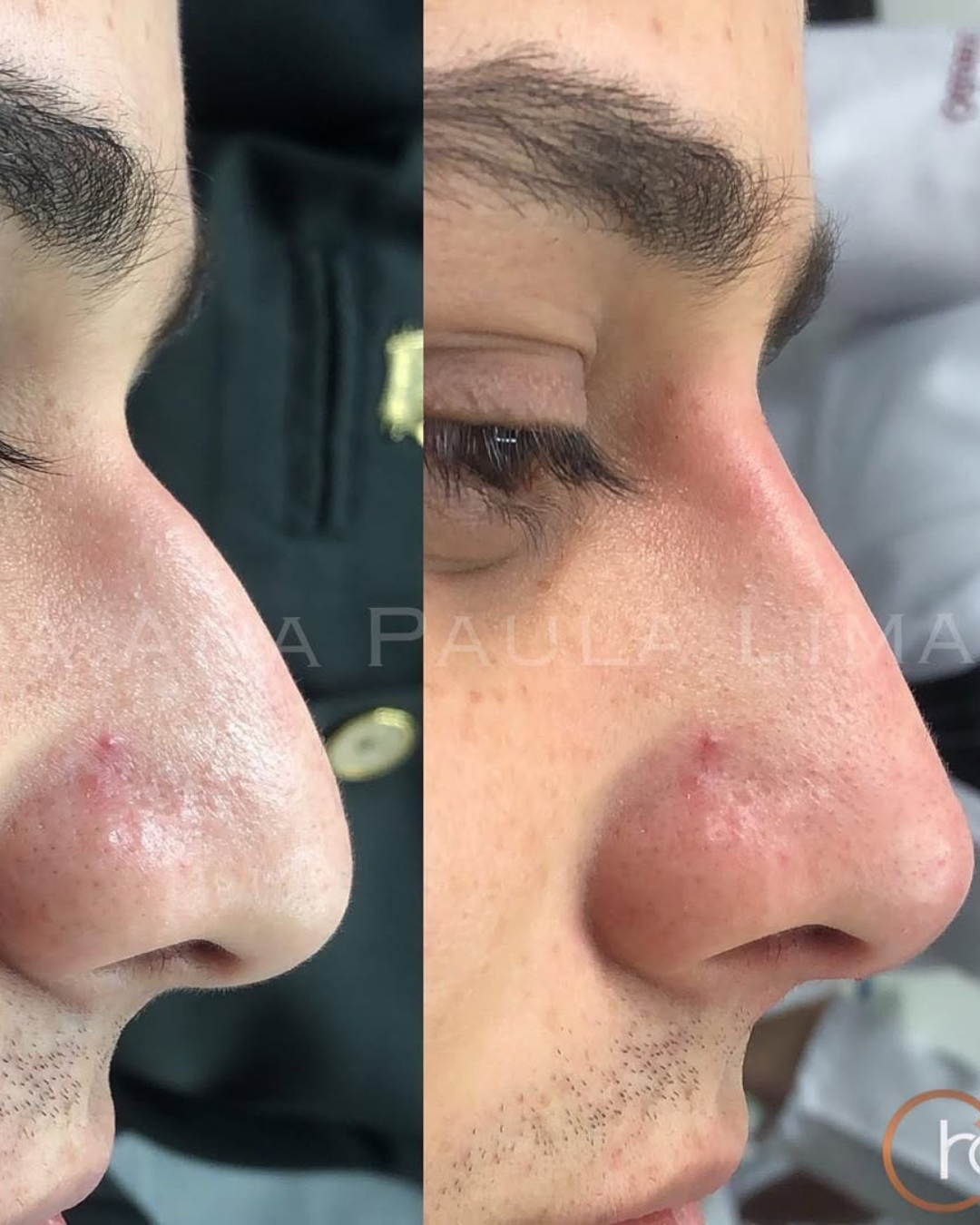 paciente harmonização orofacial 01 (10)