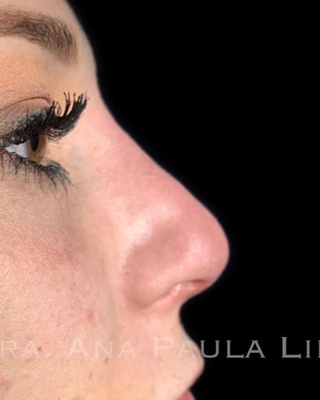 paciente harmonização orofacial 01 (3)